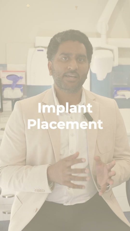 Dental Implants — Australind Dental Centre